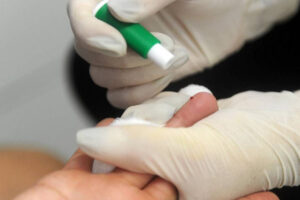 Kássio Pereira /SESA